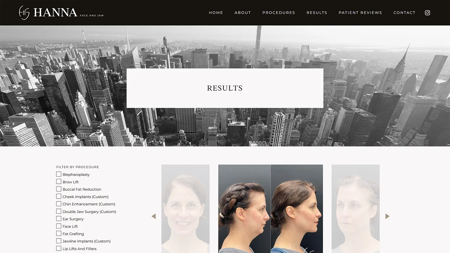 HannaFaceJaw Filterable Results Built by Celebrate Creative jpg